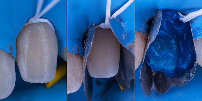 figure6_BD