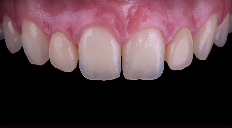 figure7_BD