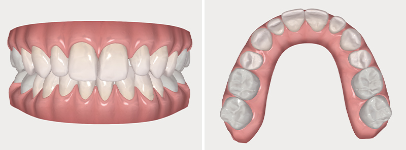 figure1-2