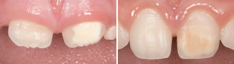 fig1-2