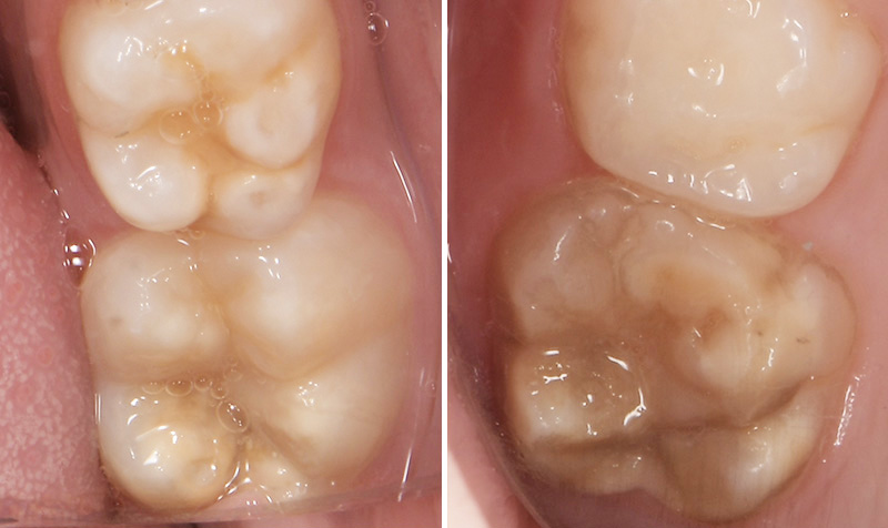 fig3-4