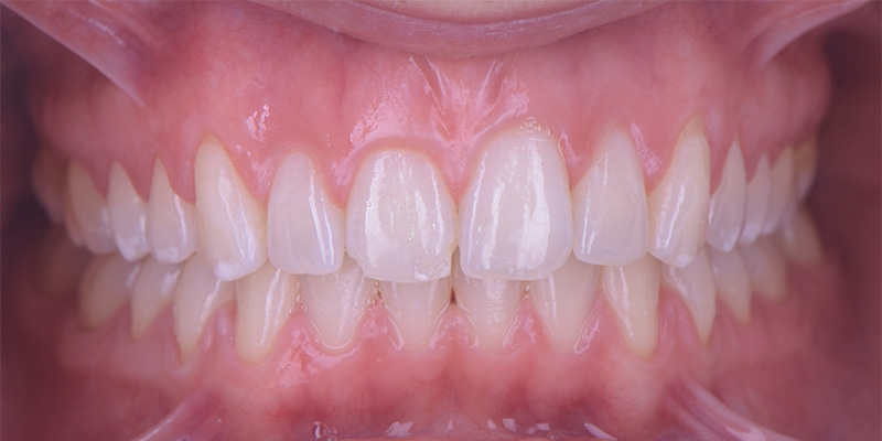 fig-03