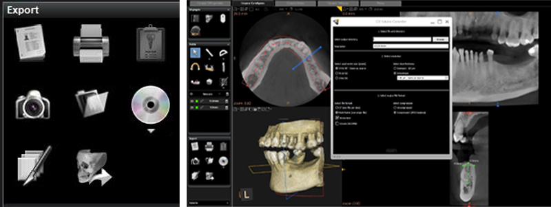 fig-04-05-amar-chirurgie-guidee