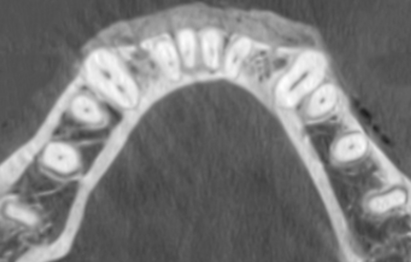 fig08-cortico