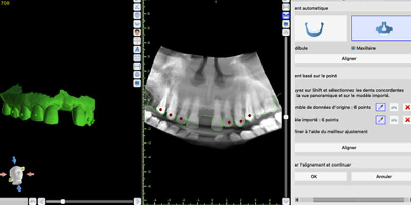 fig-04-endo-guidée