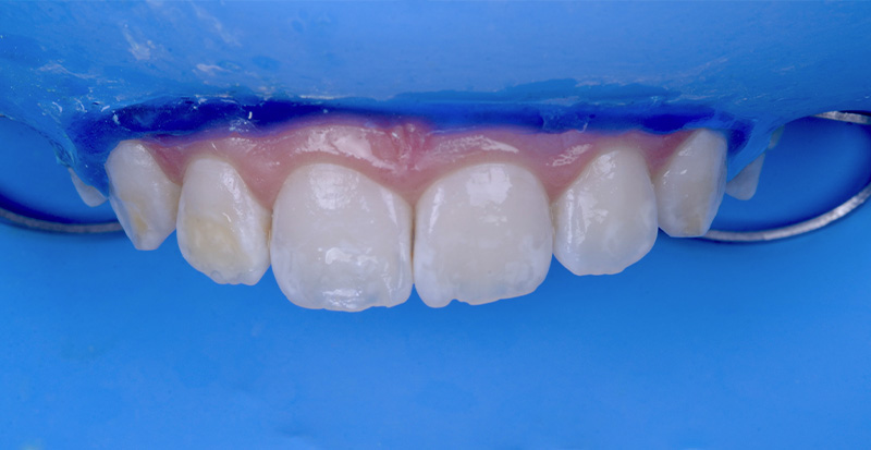fig-08