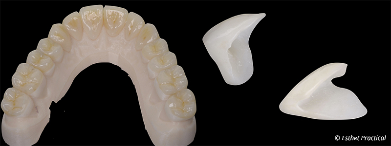 fig-14-usure