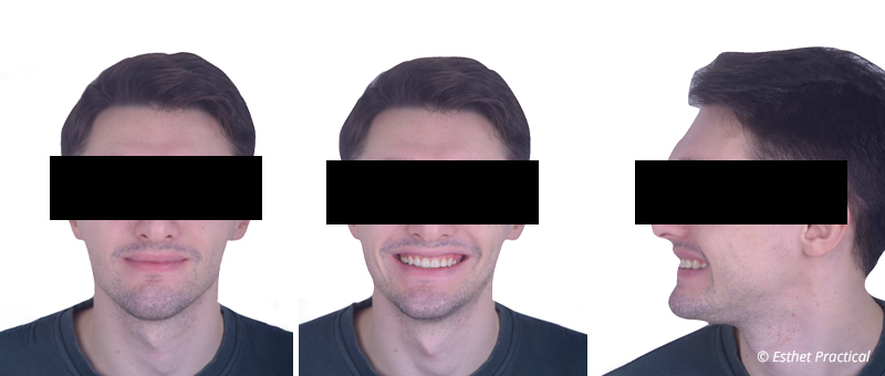 fig-21-usure