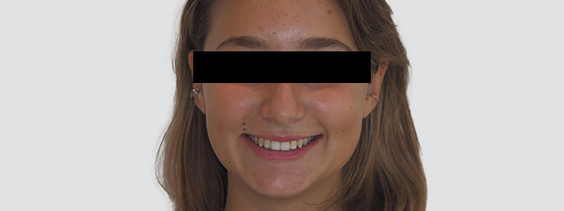 sourire harmonieux