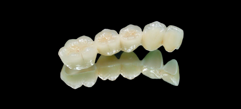 prothèse zircone